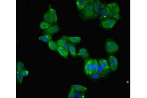 Immunofluorescent analysis of HepG2 cells using ABIN7150898 at dilution of 1:100 and Alexa Fluor 488-congugated AffiniPure Goat Anti-Rabbit IgG(H+L) (TCTE1 antibody  (AA 285-501))