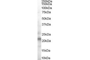 Image no. 1 for anti-Vacuolar Protein-Sorting-Associated Protein 25 (VPS25) (Internal Region) antibody (ABIN374641) (VPS25 antibody  (Internal Region))