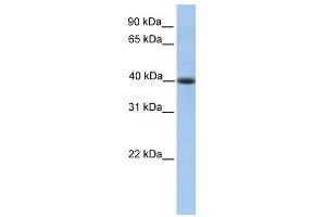 PELI3 antibody used at 1 ug/ml to detect target protein. (Pellino 3 antibody)