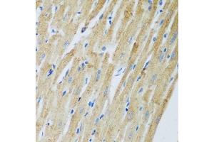 Immunohistochemistry of paraffin-embedded rat heart using ADAM12 antibody. (ADAM12 antibody  (AA 589-738))