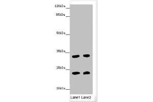 Western blot All lanes: MRAS antibody at 3. (MRAS antibody  (AA 79-208))