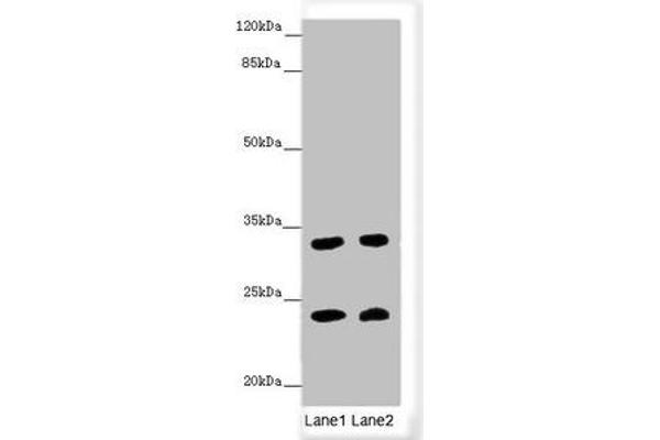 MRAS anticorps  (AA 79-208)