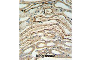 Immunohistochemistry (Paraffin-embedded Sections) (IHC (p)) image for anti-Alcohol Dehydrogenase 7 (Class IV), mu Or sigma Polypeptide (ADH7) (AA 325-354), (C-Term) antibody (ABIN950340)