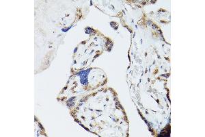 Immunohistochemistry of paraffin-embedded human placenta using ADK Rabbit pAb (ABIN7265463) at dilution of 1:300 (40x lens). (ADK antibody  (AA 200-345))