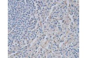 Immunohistochemical staining of formalin-fixed paraffin-embedded human tonsil tissue showing cytoplasmic staining with CASP4 polyclonal antibody  at 1 : 100 dilution. (Caspase 4 antibody)