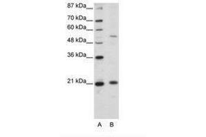 Image no. 1 for anti-Zinc Finger and SCAN Domain Containing 20 (ZSCAN20) (N-Term) antibody (ABIN203137)