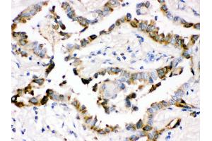 Immunohistochemistry (Paraffin-embedded Sections) (IHC (p)) image for anti-Surfactant Protein D (SFTPD) (AA 292-321), (C-Term) antibody (ABIN3043335) (SFTPD antibody  (C-Term))