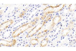 Detection of MMP13 in Rabbit Kidney Tissue using Polyclonal Antibody to Matrix Metalloproteinase 13 (MMP13) (MMP13 antibody  (AA 70-245))