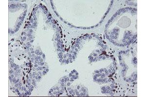 Image no. 8 for anti-Meis Homeobox 3 (MEIS3) (AA 1-261) antibody (ABIN1490671) (MEIS3 antibody  (AA 1-261))