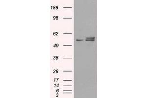 Image no. 2 for anti-ATP Synthase, H+ Transporting, Mitochondrial F1 Complex, beta Polypeptide (ATP5B) antibody (ABIN1496766) (ATP5B antibody)