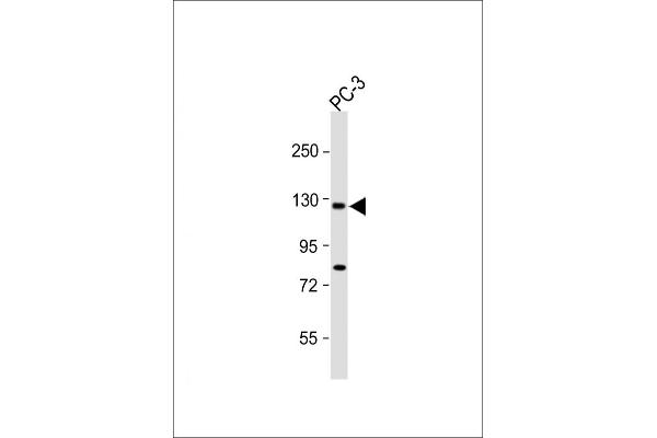 TRPM8 antibody  (C-Term)