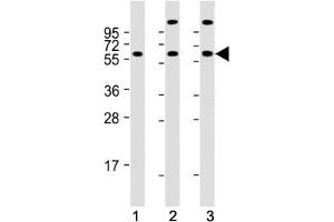 Western blot testing of human 1) K562, 2) 293 and 3) Jurkat cell lysate with HSP60 antibody. (HSPD1 antibody  (AA 80-109))