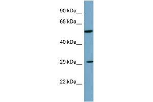Host: Rabbit Target Name: DKK1 Sample Type: PANC1 Whole Cell lysates Antibody Dilution: 1.