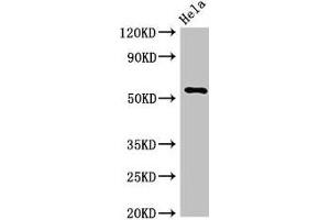Western Blot Positive WB detected in: Hela whole cell lysate All lanes: KRT7 antibody at 3 μg/mL Secondary Goat polyclonal to rabbit IgG at 1/50000 dilution Predicted band size: 52 kDa Observed band size: 52 kDa