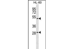ZN Antibody (C-term) (ABIN1537399 and ABIN2849742) western blot analysis in HL-60 cell line lysates (35 μg/lane). (ZNF324 antibody  (C-Term))
