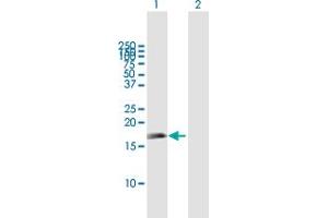 Western Blot analysis of APITD1 expression in transfected 293T cell line by APITD1 MaxPab polyclonal antibody. (APITD1 antibody  (AA 1-138))