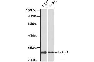 Western blot analysis of extracts of various cell lines using TRADD Polyclonal Antibody at dilution of 1:1000. (TRADD antibody)
