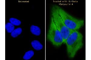 Immunofluorescent analysis of 4 % paraformaldehyde-fixed, 0. (TR4 antibody  (pSer439))