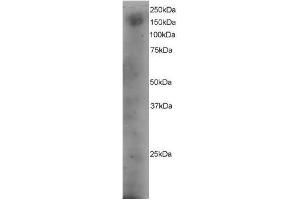Image no. 1 for anti-Dedicator of Cytokinesis 1 (DOCK1) (C-Term) antibody (ABIN374114) (DOCK1 antibody  (C-Term))
