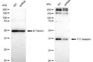 Western blotting analysis using F11 receptor antibody (ABIN7798557). (Recombinant F11R antibody)