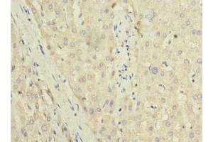 Immunohistochemistry of paraffin-embedded human liver tissue using ABIN7173508 at dilution of 1:100 (TRIT1 antibody  (AA 1-324))