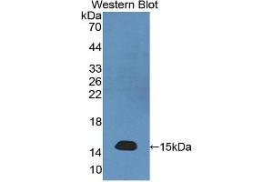 Western Blotting (WB) image for anti-Neurofilament, Light Polypeptide (NEFL) (AA 281-396) antibody (ABIN1176228) (NEFL antibody  (AA 281-396))