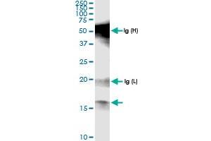 Immunoprecipitation of POLR1D transfected lysate using anti-POLR1D MaxPab rabbit polyclonal antibody and Protein A Magnetic Bead , and immunoblotted with POLR1D MaxPab rabbit polyclonal antibody (D01) . (POLR1D antibody  (AA 1-133))