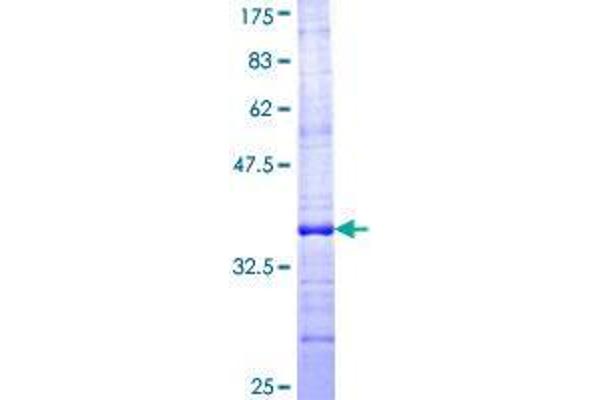 TUSC2 Protein (AA 31-110) (GST tag)