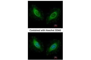 ICC/IF Image Immunofluorescence analysis of methanol-fixed HeLa, using Calmodulin 2, antibody at 1:500 dilution. (Calmodulin 2 antibody)