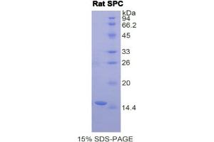 SDS-PAGE analysis of Rat SPC Protein. (Surfactant Protein C Protein (SFTPC))