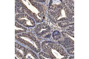 IHC analysis of SAP130 using anti-SAP130 antibody (ABIN7601247). (SAP130 antibody  (AA 309-913))