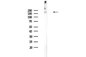 anti-Kinesin Family Member 20B (KIF20B) (N-Term) antibody