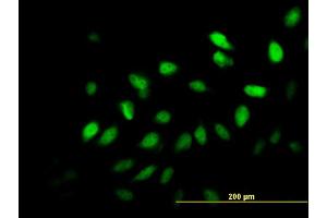 Immunofluorescence of monoclonal antibody to SURB7 on HeLa cell. (MED21 antibody  (AA 1-144))