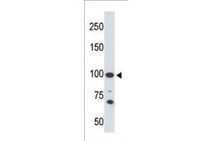 The anti-ACE2 C-term Pab f is used in Western blot to detect ACE2 in 293 cell lysate. (ACE2 antibody  (C-Term))