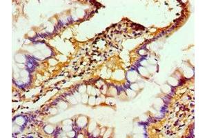 Immunohistochemistry of paraffin-embedded human small intestine tissue using ABIN7150218 at dilution of 1:100