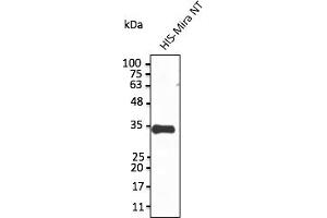 Western Blotting (WB) image for anti-Sarcolemma Associated Protein (SLMAP) (N-Term) antibody (ABIN7273079) (SLMAP antibody  (N-Term))