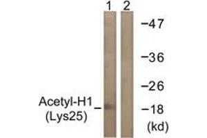 Western blot analysis of extracts from COS7 cells, treated with TSA 400nM 24h, using Histone H1 (Acetyl-Lys25) Antibody.