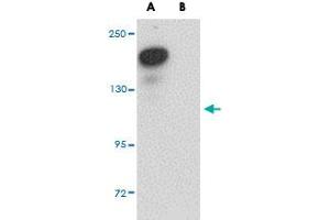 Western blot analysis of PLEKHM2 in rat brain tissue lysate with PLEKHM2 polyclonal antibody  at 0. (PLEKHM2 antibody  (C-Term))