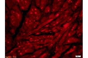 Formalin-fixed and paraffin embedded rat heart labeled with Anti- ACHE/Acetylcholinesterase Polyclonal Antibody, Unconjugated (ABIN741330) at 1:200 followed by conjugation to the secondary antibody Goat Anti-Rabbit IgG, Cy3 conjugated used at 1:200 dilution for 40 minutes at 37°C (Acetylcholinesterase antibody  (AA 521-614))