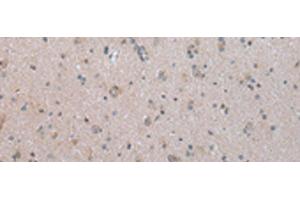 Immunohistochemistry of paraffin-embedded Human brain tissue using COX17 Polyclonal Antibody at dilution of 1:45(x200) (COX17 antibody)