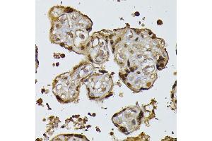 Immunohistochemistry of paraffin-embedded human placenta using RPS27A antibody (ABIN7270022) at dilution of 1:100 (40x lens). (RPS27A antibody  (AA 1-156))