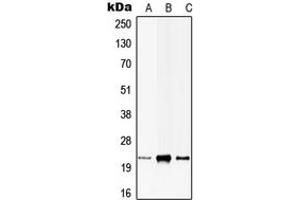 Western blot analysis of CIB1 expression in HEK293T (A), H9C2 (B), rat brain (C) whole cell lysates.