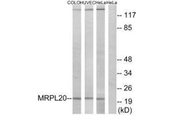 MRPL2 antibody  (C-Term)