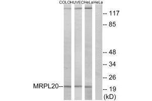 Western blot analysis of extracts from COLO cells, HUVEC cells and HeLa cells, using MRPL20 antibody. (MRPL2 antibody  (C-Term))