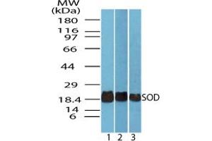 Image no. 1 for anti-Superoxide Dismutase antibody (ABIN1496240) (Superoxide Dismutase antibody)
