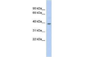 WB Suggested Anti-APOL6 Antibody Titration:  0. (APOL6 antibody  (Middle Region))