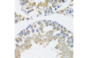 Immunohistochemistry of paraffin-embedded mouse testis using POLG2 antibody (ABIN5974040) at dilution of 1/100 (40x lens). (POLG2 antibody)