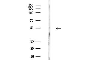 anti-Potassium Voltage-Gated Channel, Shaw-Related Subfamily, Member 1 (KCNC1) (C-Term) antibody