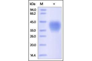 Human CD48, His Tag on SDS-PAGE under reducing (R) condition. (CD48 Protein (CD48) (AA 27-220) (His tag))