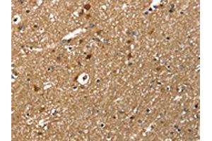 The image on the left is immunohistochemistry of paraffin-embedded Human brain tissue using ABIN7131518(TWF1 Antibody) at dilution 1/30, on the right is treated with fusion protein. (TWF1 antibody)
